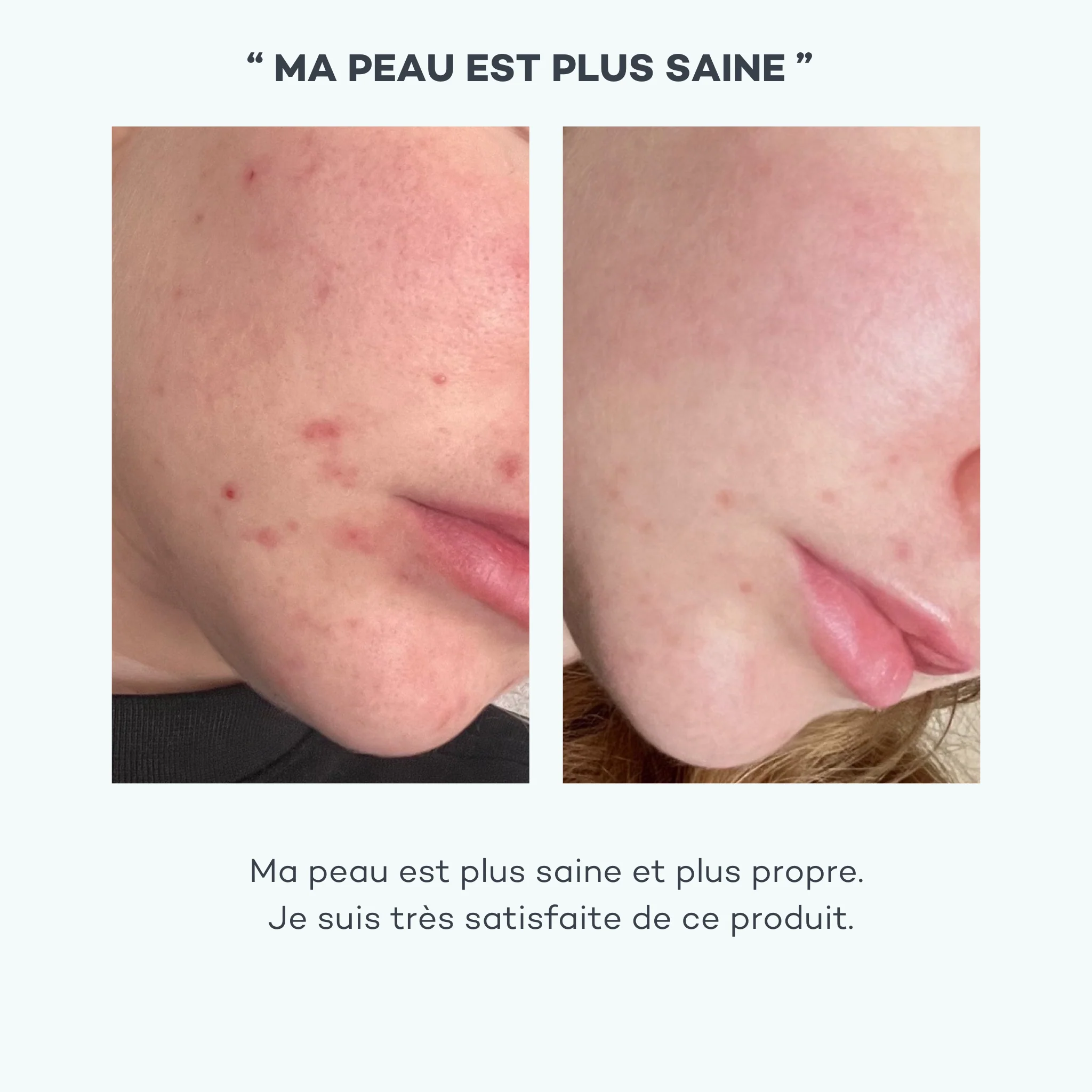 Absolu de Zinc - Image 5