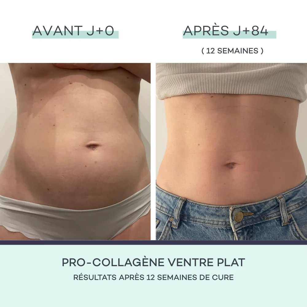 Coffret Minceur - Mangue - Image 4